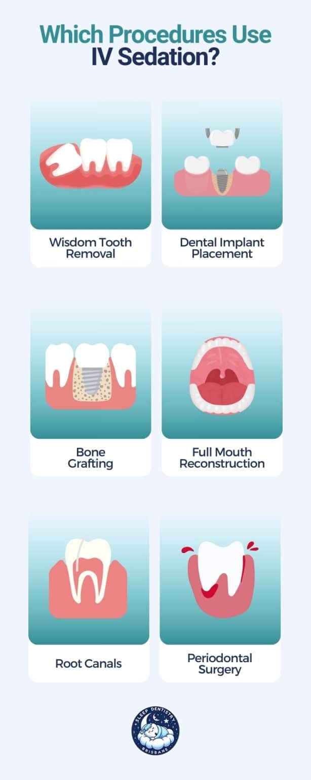 which of these procedures use iv sedation