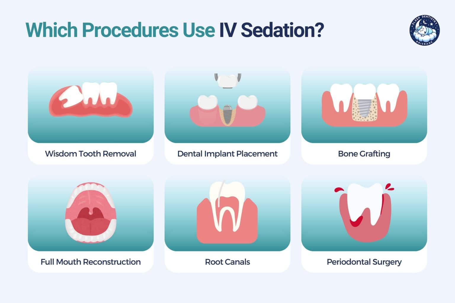 which procedures use iv sedation